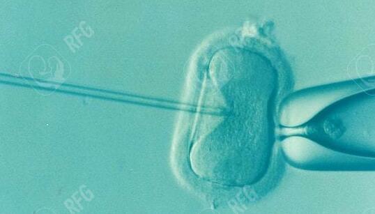 试管婴儿技术（IVF）的费用大概是多少？