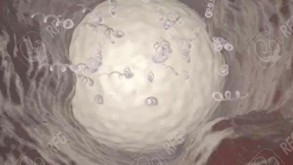 不同的PGT技术之间有何差异?哪些患者不适合进行PGT?