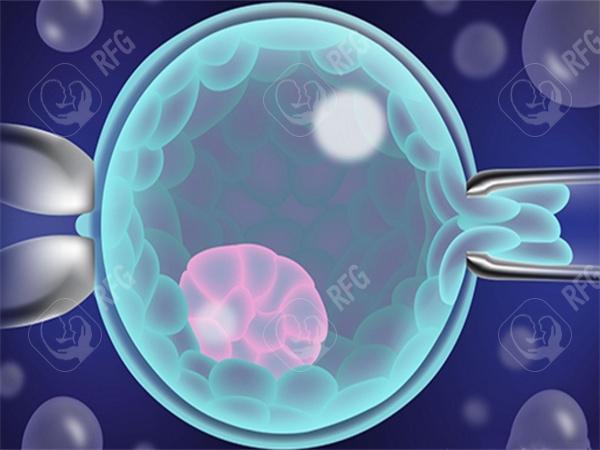 2025年南京做试管婴儿多少钱?各个环节的详细费用是哪些?